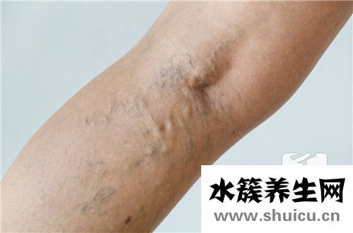 血管擴張