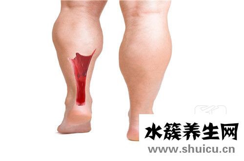 跟腱二斷