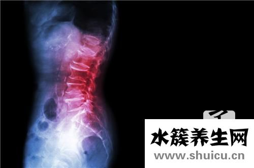 脊柱小關節紊亂