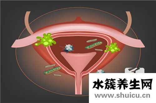 膀胱炎和尿道炎區別
