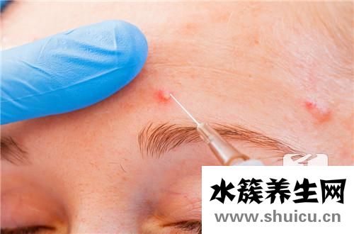 麻疹皮膚病