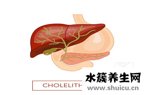 膽囊炎治療