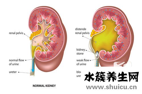 低密度灶