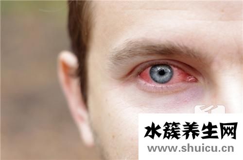 皰疹性結膜炎