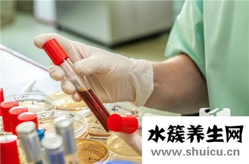 原發性血小板減少癥