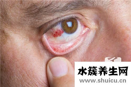 球結膜