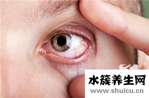 球結膜