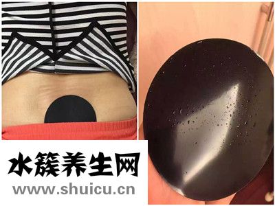 治療閉經