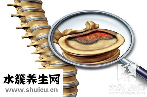 副腫瘤綜合征