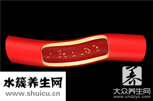 動脈血管堵塞