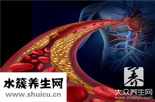 動脈血管堵塞