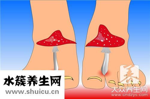 跑步腳底疼