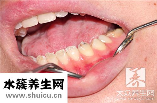 牙齒黃辦小竅門
