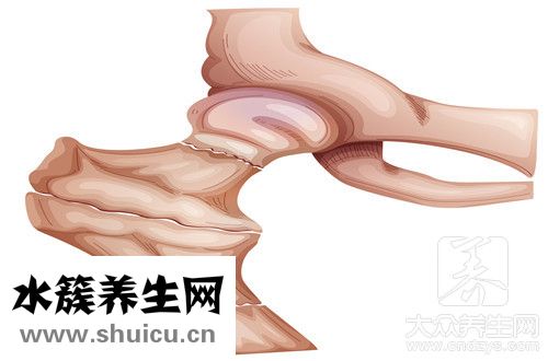 糾正骨盆