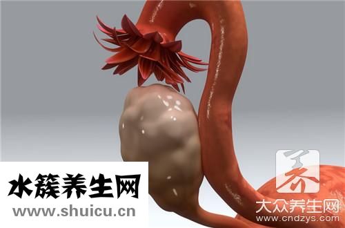 潴留囊腫