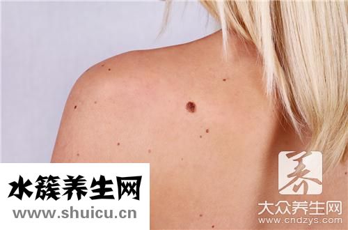 胎記危害