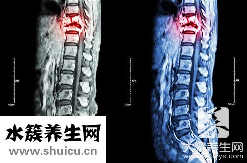 脊髓神經