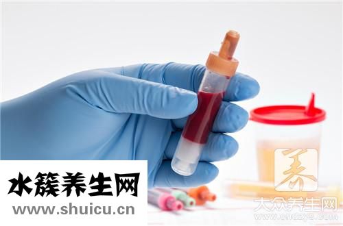血清胰島素