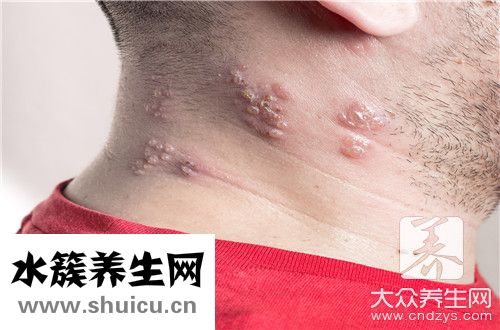 下巴腫