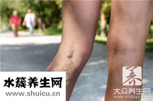 活動性出血