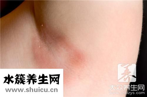 脖子起紅疹