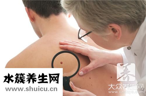 膠質瘤能治好嗎