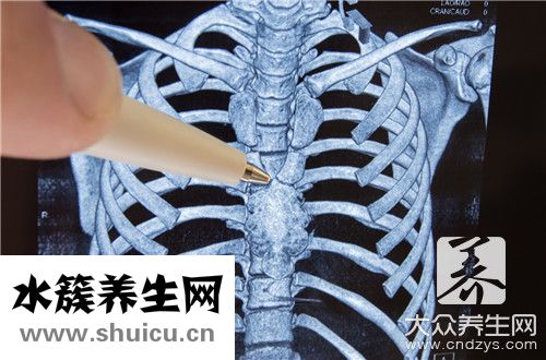 膠質瘤能治好嗎