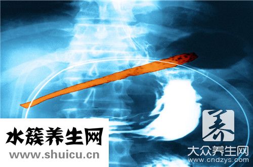 洗胃注意事項