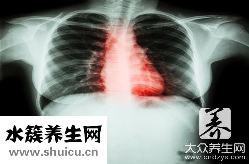 心瓣膜