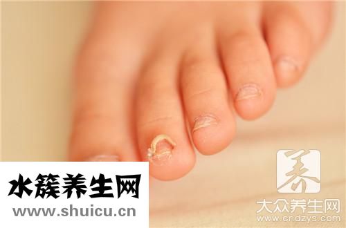 我灰指甲自愈了