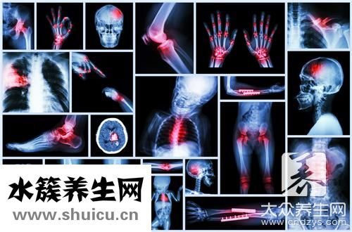 手舟骨