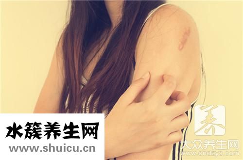 皮膚表面疼