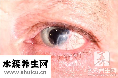 眼瞼上長小水泡