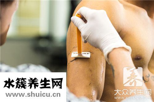 胳膊上有癬