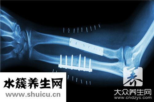 尺橈骨骨折