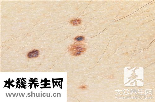 切痣留疤圖
