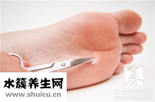 眼皮疣同