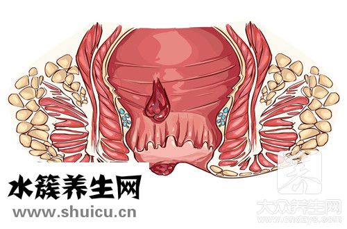 擦屁股有血