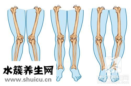 腿關節酸痛