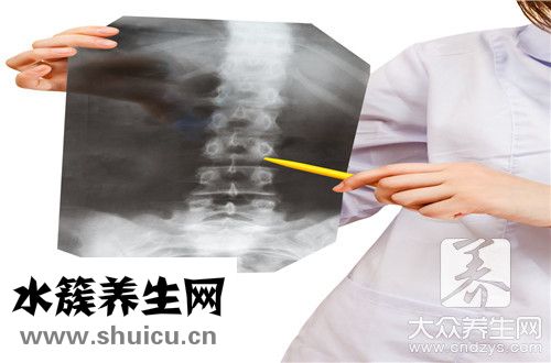 脊柱關節病