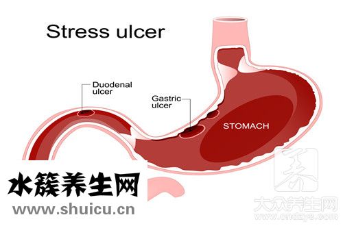 舌苔黃厚回事