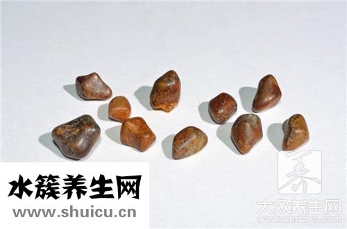 碎石治療