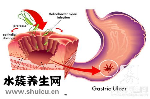 舌苔黃厚回事