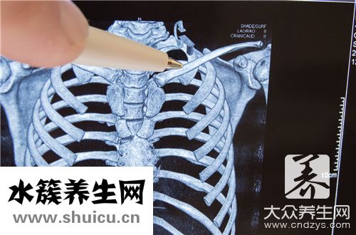 壓迫神經