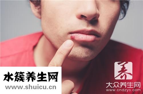 嘴唇皰疹快速消除