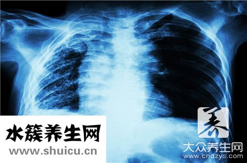 肺結核不能吃什么
