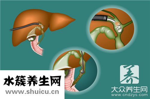 膽囊正常大小