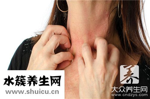神經性皮炎形成原因