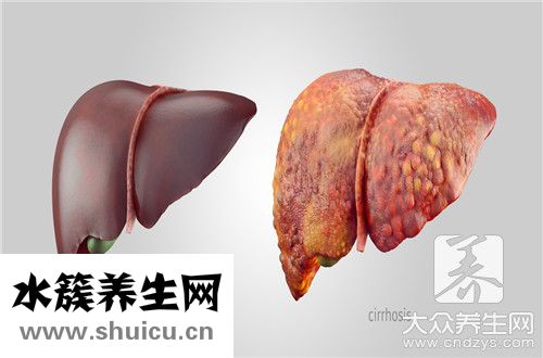 查乙肝抗體