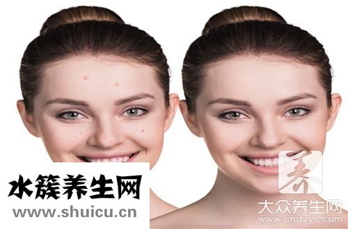頭皮毛囊堵塞